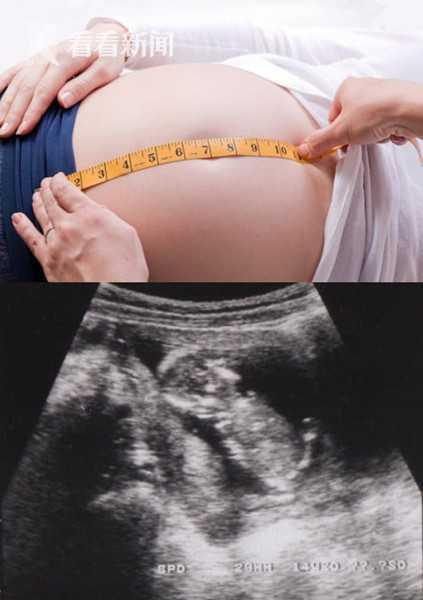 日本孕妇生产