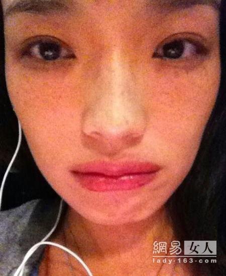 明星有雀斑吗